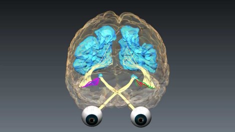 Neuroplasticidad por Moshé Feldenkrais-